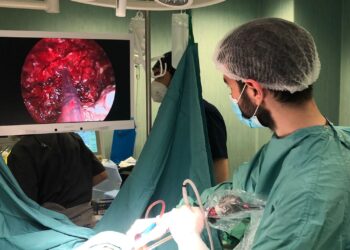 Chirurgia toracica: giovane medico di Sant’Arsenio nel team di eccellenza del Vanvitelli di Napoli