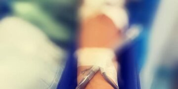 Carenza di sangue negli ospedali: nel periodo estivo si riducono le donazioni. L’appello dell’Avis Salerno