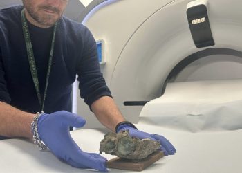 Pompei, scoperto il “medico dei fuggiaschi”: nuovi esami sui calchi rivelano strumenti chirurgici