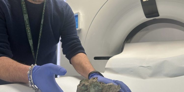 Pompei, scoperto il “medico dei fuggiaschi”: nuovi esami sui calchi rivelano strumenti chirurgici